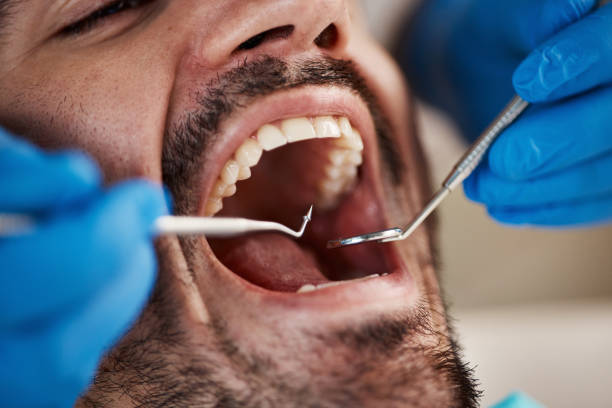 Best Emergency Gum Treatment in Divernon, IL